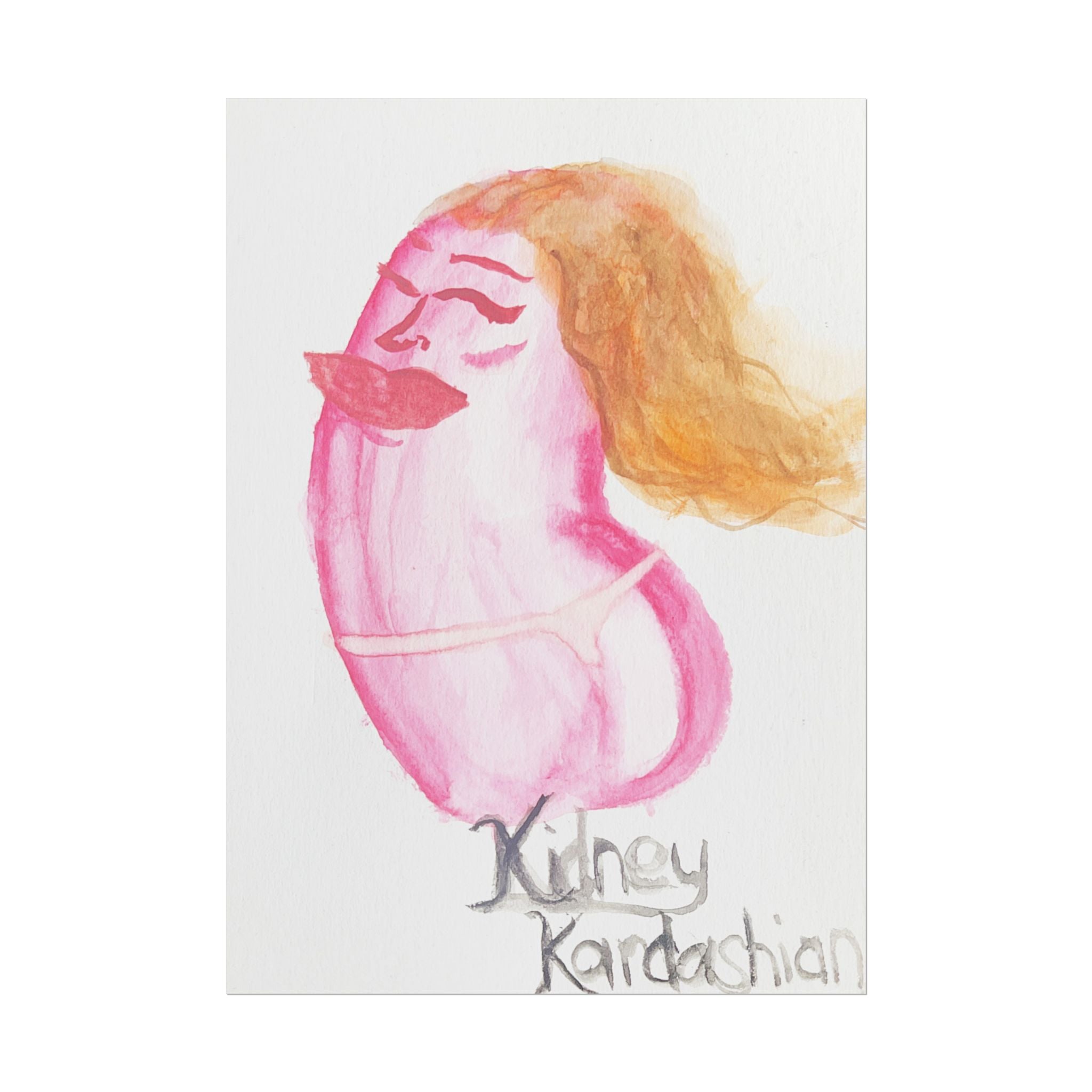 Kidney Kardashian – Art Print